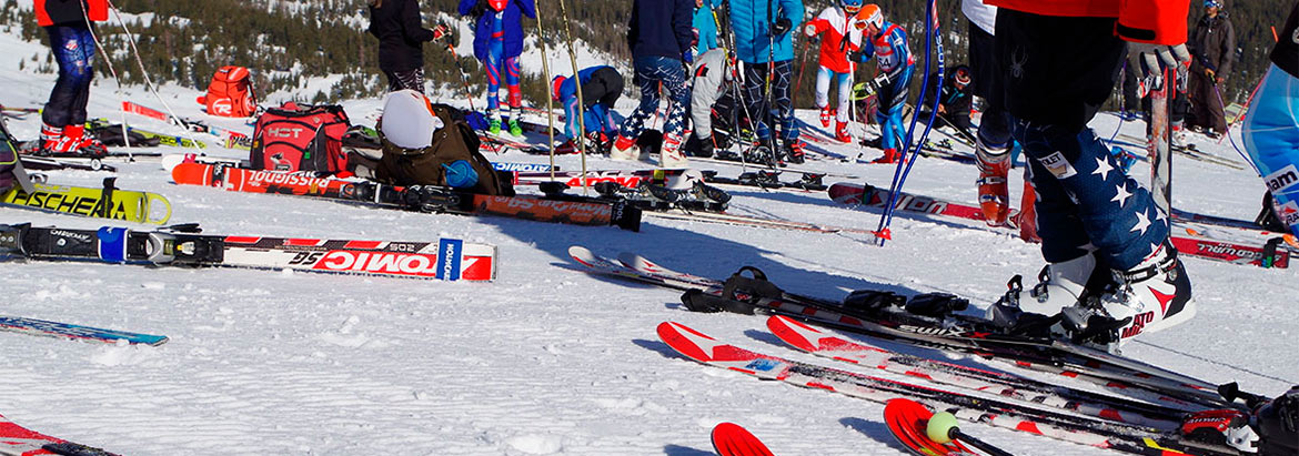 Горные лыжи